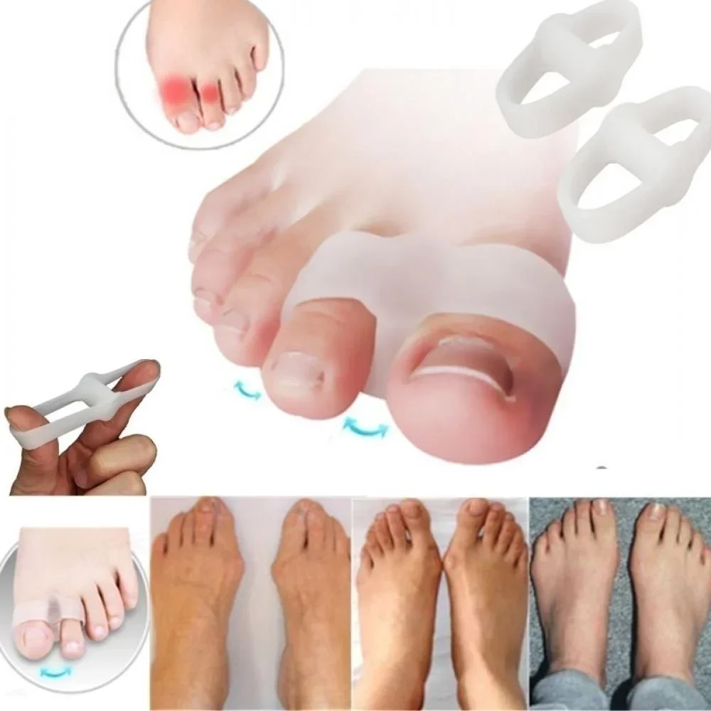 2 Holes Bunion Corrector Pain  - Correction Fluid White บทวิจารณ์และราคา
